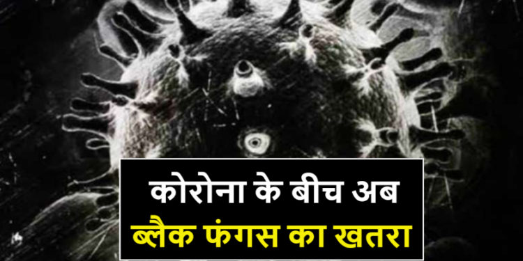 जानलेवा ब्लैक फंगस क्या है? जानिए क्या हैं लक्षण और इसका इलाज